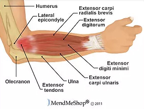 Elbow - Medial and Lateral Epicondylitis - Orthopedic